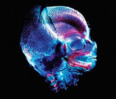  Image source: Craniofacial Embryogenetics and Development- Geoffrey H. Sperber, Steven M. Sperber